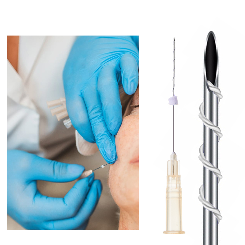 PCL Tornado Screw Threads 26G 27G