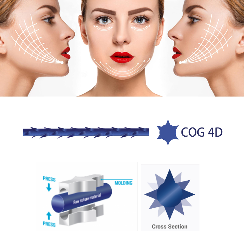 Natural Contouring with Deenora PDO Threads