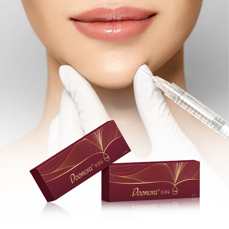 The 2nd Generation Injectable Hyaluronic Acid Filler