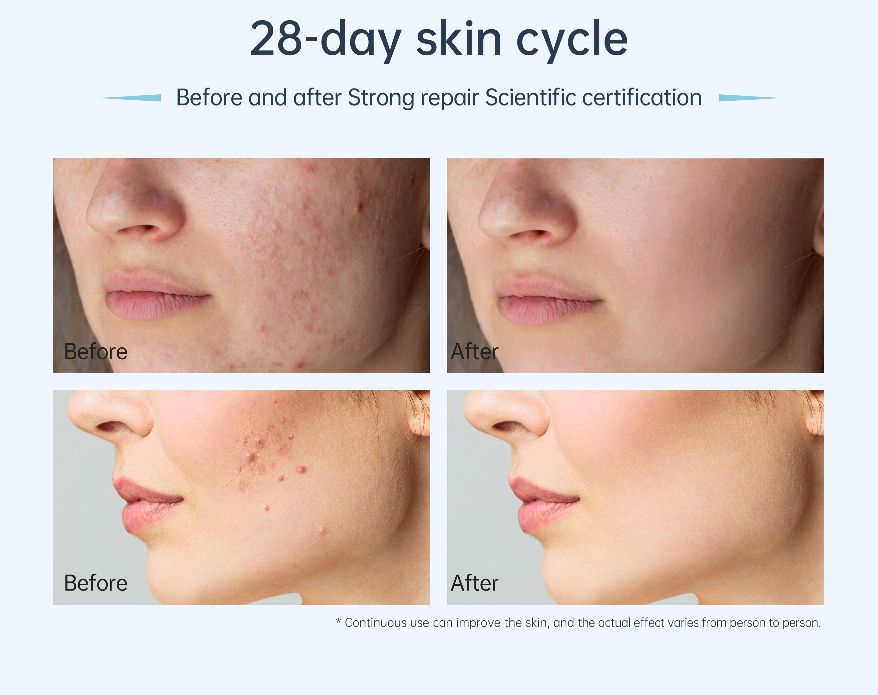 Dr. Pen A11 Microneedling Pen – Official Authorized Store | Advanced Professional Microneedling System with Smart Display