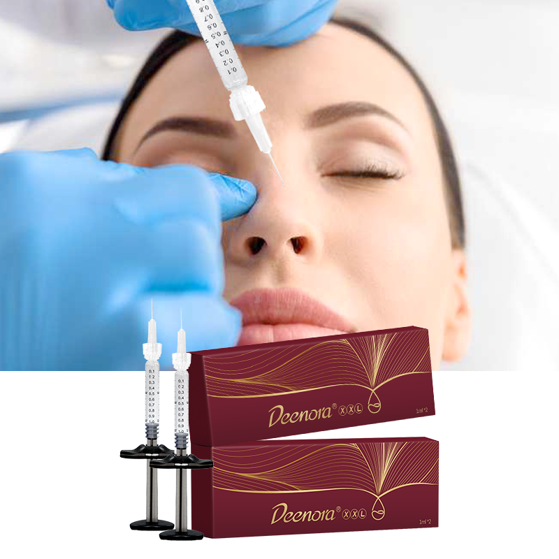 The 2nd Generation Injectable Hyaluronic Acid Filler