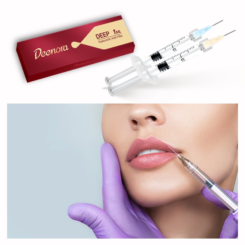 Deenora Hyaluronic Acid Fillers Smooth Lines Restored Volume