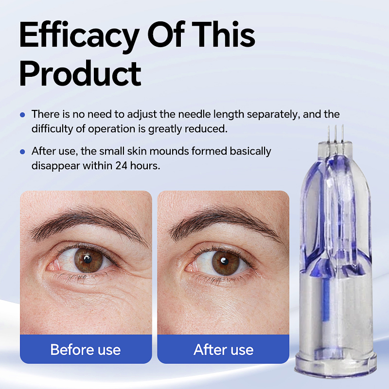 Nanosoft 3 Pin Microneedle Smallest Needle Painless Injection